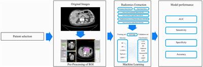Application of Radiomics Analysis Based on CT Combined With Machine Learning in Diagnostic of Pancreatic Neuroendocrine Tumors Patient’s Pathological Grades